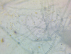Byssocorticium atrovirens