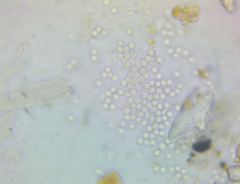 Byssocorticium atrovirens
