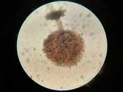Rhizopus