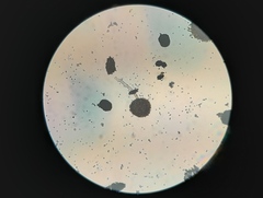 Rhizopus