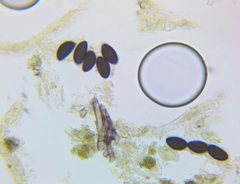 Hypoxylon perforatum