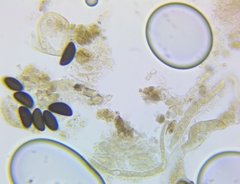 Hypoxylon perforatum