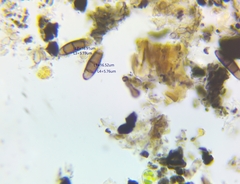 Hysterium angustatum