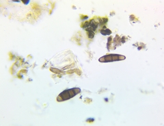 Hysterium angustatum