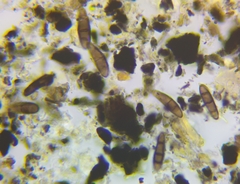 Hysterium angustatum