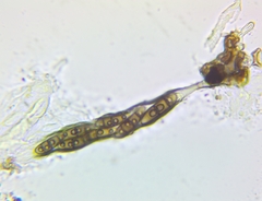 Hysterium angustatum