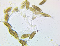 Hysterium angustatum