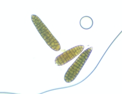 Berkleasmium concinnum