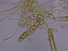 Coprotus
