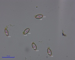 Coprotus