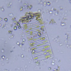 Fragilaria
