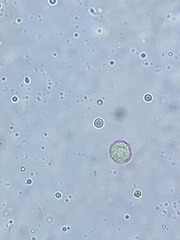 Chlamydomonas nivalis