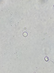 Chlamydomonas nivalis