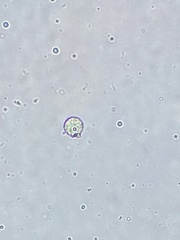 Chlamydomonas nivalis