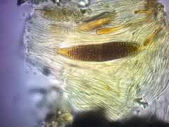 Ocellularia jacinda-arderniae