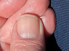 Rytidosperma caespitosum