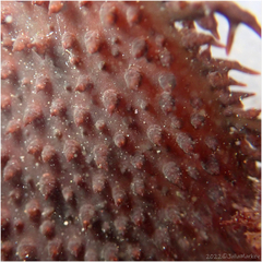Chondracanthus