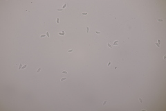 Botryobasidium subcoronatum