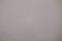 Botryobasidium subcoronatum