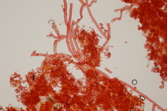 Botryobasidium subcoronatum