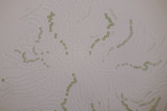 Hypocrea aureoviridis