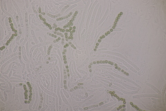 Hypocrea aureoviridis