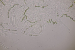 Hypocrea aureoviridis