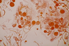 Tremella globispora
