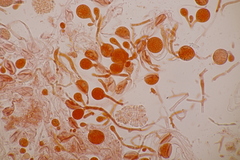 Tremella globispora