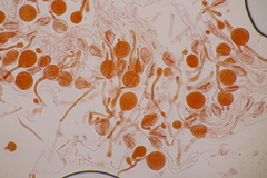 Tremella globispora