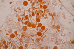 Tremella globispora