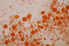 Tremella globispora