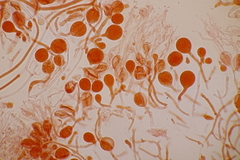 Tremella globispora