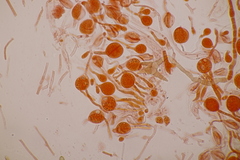 Tremella globispora
