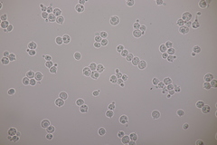 Tremella globispora