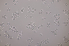 Tremella globispora