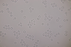 Tremella globispora