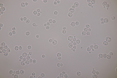 Tremella globispora
