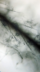 Engyodontium aranearum