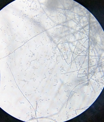 Engyodontium aranearum