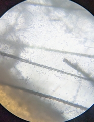 Engyodontium aranearum