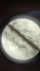 Engyodontium aranearum