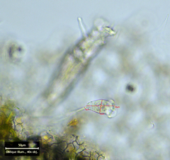 Vorticella