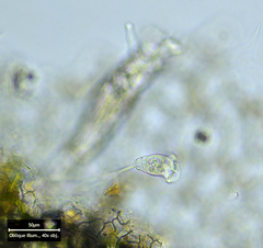 Vorticella