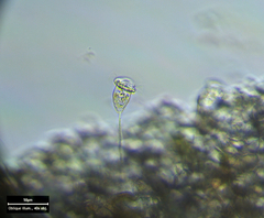 Vorticella