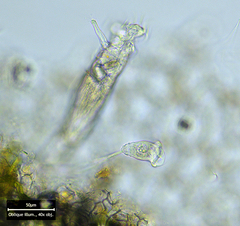 Vorticella