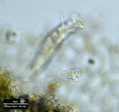 Vorticella