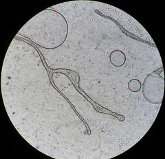 Lycogala epidendrum terrestre