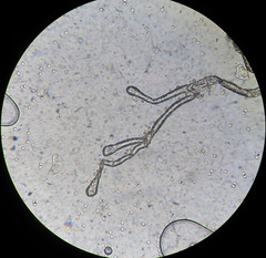 Lycogala epidendrum terrestre