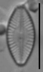 Microcostatus